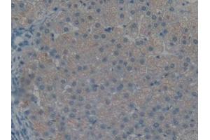Immunohistochemistry (IHC) image for anti-Advanced Glycosylation End Product-Specific Receptor (AGER) (AA 173-418) antibody (ABIN1860397)