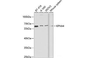 Western blot analysis of extracts of various cell lines using KPNA4 Polyclonal Antibody at dilution of 1:1000. (KPNA4 抗体)