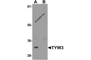 Western Blotting (WB) image for anti-tRNA-YW Synthesizing Protein 3 Homolog (TYW3) (Middle Region) antibody (ABIN1031152) (TYW3 抗体  (Middle Region))