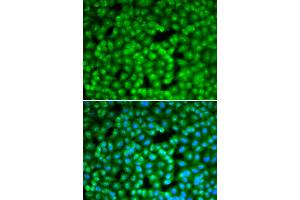 Immunofluorescence analysis of A549 cells using FBL antibody (ABIN6292110).