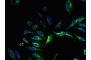 Immunofluorescent analysis of Hela cells using ABIN7164529 at dilution of 1:100 and Alexa Fluor 488-congugated AffiniPure Goat Anti-Rabbit IgG(H+L) (GPX8 抗体  (AA 41-209))