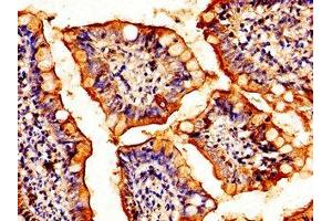 Immunohistochemistry of paraffin-embedded human small intestine tissue using ABIN7154893 at dilution of 1:100 (HSF2 抗体  (AA 79-173))