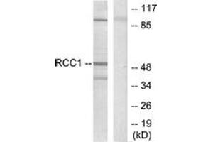 Western blot analysis of extracts from HepG2 cells, using Retinoic Acid Receptor beta Antibody. (Retinoic Acid Receptor beta 抗体  (AA 331-380))