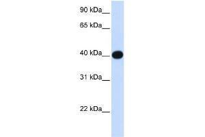 WB Suggested Anti-LIAS Antibody Titration:  0. (LIAS 抗体  (N-Term))