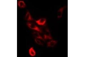Immunofluorescent analysis of TC-PTP staining in Jurkat cells. (PTPN2 抗体)