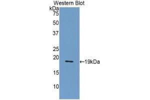 Western blot analysis of the recombinant protein. (NUCB2 抗体  (AA 108-246))