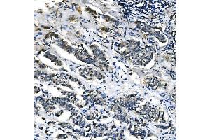 IHC analysis of PCK2 using anti-PCK2 antibody (ABIN7599509). (PEPCK 抗体  (AA 1-640))