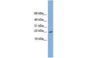 Human THP-1; WB Suggested Anti-RPS13 Antibody Titration: 0. (RPS13 抗体  (Middle Region))
