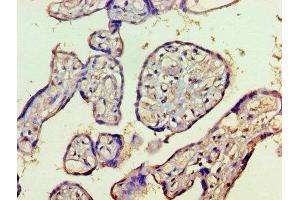Immunohistochemistry of paraffin-embedded human placenta tissue using ABIN7155327 at dilution of 1:100 (HDAC8 抗体  (AA 1-377))
