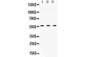 Western blot analysis of TGFBR1 expression in rat cardiac muscle extract ( Lane 1), mouse liver extract ( Lane 2) and HELA whole cell lysates ( Lane 3). (TGFBR1 抗体  (N-Term))