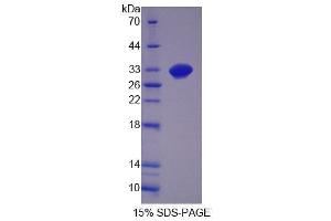 SDS-PAGE analysis of Mouse GDF11 Protein. (GDF11 蛋白)