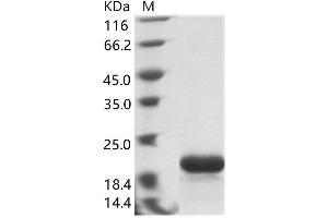 Zaire Ebola Virus Nucleoprotein (ZEBOV NP) protein (His tag)
