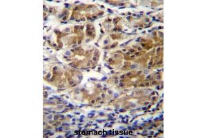 Immunohistochemistry (IHC) image for anti-Pyruvate Dehydrogenase Phosphatase Regulatory Subunit (PDPR) antibody (ABIN2996488) (PDPR 抗体)