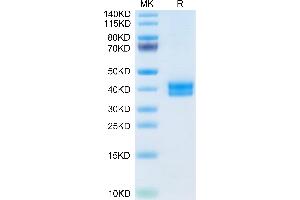 SDS-PAGE (SDS) image for Cell Adhesion Molecule 3 (CADM3) (AA 23-328) protein (His tag) (ABIN7274329)