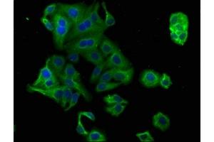 Immunofluorescence staining of HepG2 cells with ABIN7164836 at 1:100, counter-stained with DAPI. (PCSK9 抗体  (AA 462-595))