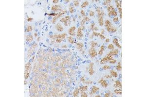 Immunohistochemistry of paraffin-embedded mouse pancreas using PLG1B antibody (ABIN6129428, ABIN6145724, ABIN6145725 and ABIN6221143) at dilution of 1:100 (40x lens). (PLA2G1B 抗体  (AA 23-148))