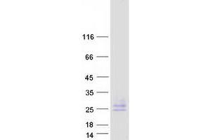 Western Blotting (WB) image for Peripheral Myelin Protein 22 (PMP22) (Transcript Variant 1) protein (Myc-DYKDDDDK Tag) (ABIN2729216)