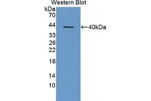 Detection of Recombinant ECH1, Human using Polyclonal Antibody to Enoyl Coenzyme A Hydratase 1, Peroxisomal (ECH1) (ECH1 抗体  (AA 1-328))