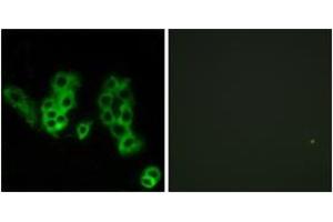 Immunofluorescence analysis of MCF7 cells, using Encephalopsin Antibody. (OPN3 抗体  (AA 161-210))