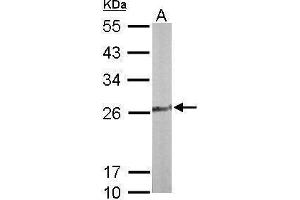 WB Image Sample (50 ug of whole cell lysate) A: Mouse liver 12% SDS PAGE antibody diluted at 1:1000 (TPK1 抗体)
