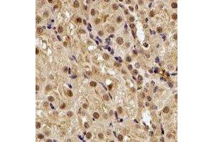 Immunohistochemical analysis of SMYD1 staining in rat kidney formalin fixed paraffin embedded tissue section. (SMYD1 抗体)
