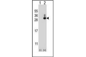 Western blot analysis of MOBKL1B (arrow) using MOBKL1B Antibody (N-term) Cat. (MOB1A 抗体  (N-Term))