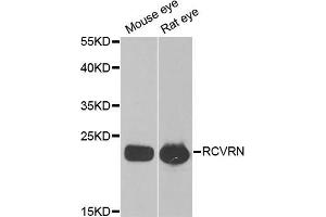 Western blot analysis of extracts of various cell lines, using RCVRN antibody (ABIN5973805) at 1/1000 dilution. (Recoverin 抗体)