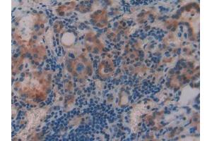 Immunohistochemistry (IHC) image for anti-Nuclear Receptor Subfamily 3, Group C, Member 1 (Glucocorticoid Receptor) (NR3C1) (AA 41-184) antibody (ABIN1174819)