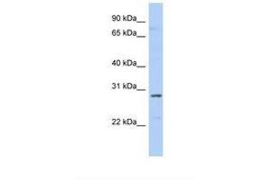 Image no. 1 for anti-Small Nuclear Ribonucleoprotein Polypeptide A (SNRPA) (N-Term) antibody (ABIN6737922)