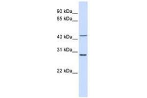 Image no. 1 for anti-Ribosomal Protein L3 (RPL3) (AA 36-85) antibody (ABIN6741022) (RPL3 抗体  (AA 36-85))