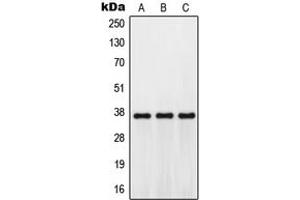 Western blot analysis of GPR171 expression in Jurkat (A), mouse kidney (B), H9C2 (C) whole cell lysates. (GPR171 抗体  (Center))