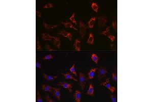 Immunofluorescence analysis of C6 cells using Bax Rabbit mAb  at dilution of 1:100 (40x lens). (BAX 抗体)