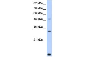 WB Suggested Anti-CNOT7 Antibody Titration:  0. (CNOT7 抗体  (N-Term))