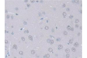 Detection of ITSN1 in Rat Cerebrum Tissue using Polyclonal Antibody to Intersectin 1 (ITSN1) (ITSN1 抗体  (AA 1-227))