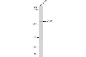 WB Image mTOR antibody [C1], Internal detects mTOR protein by western blot analysis. (MTOR 抗体  (Internal Region))
