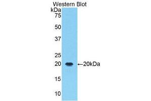 Western Blotting (WB) image for anti-Arachidonate 5-Lipoxygenase (ALOX5) (AA 374-536) antibody (ABIN1174531) (ALOX5 抗体  (AA 374-536))