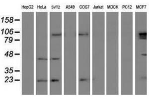 Image no. 2 for anti-Ubiquitin-Conjugating Enzyme E2E 3 (UBE2E3) antibody (ABIN1501616) (UBE2E3 抗体)