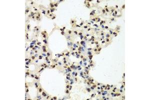Immunohistochemistry (Paraffin-embedded Sections) (IHC (p)) image for anti-Non-POU Domain Containing, Octamer-Binding (NONO) (AA 1-300) antibody (ABIN6144713)