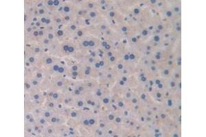 Immunohistochemistry (IHC) image for anti-Transferrin (TF) (AA 360-682) antibody (ABIN1078589)