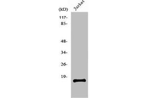 Western Blot analysis of Jurkat cells using PDGF-A Polyclonal Antibody (PDGFA 抗体  (Internal Region))