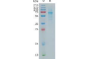 SDS-PAGE (SDS) image for Collectin Sub-Family Member 10 (C-Type Lectin) (COLEC10) (AA 28-277) protein (Fc Tag) (ABIN6964183)
