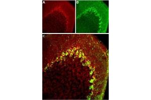 Immunohistochemistry (IHC) image for anti-Calcium Channel, Voltage-Dependent, T Type, alpha 1H Subunit (CACNA1H) (AA 581-595), (Intracellular) antibody (ABIN7043010)