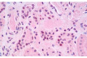 Immunohistochemistry analysis of paraffin-embedded Human Kidney using RELB Polyclonal Antibody. (RELB 抗体)