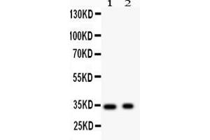 Anti- Synaptophysin Picoband antibody, Western blottingAll lanes: Anti Synaptophysin  at 0. (Synaptophysin 抗体  (N-Term))