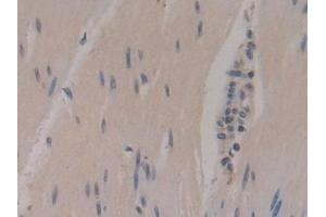 Detection of NSE in Human Rectum Tissue using Polyclonal Antibody to Enolase, Neuron Specific (NSE) (ENO2/NSE 抗体  (AA 2-285))