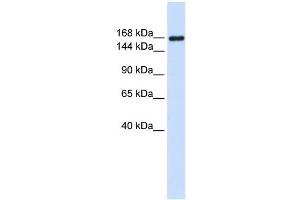 Laminin Gamma 1 antibody used at 1 ug/ml to detect target protein. (Laminin gamma 1 抗体)