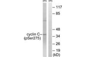 Western blot analysis of extracts from NIH-3T3 cells treated with UV 15', using Cyclin C (Phospho-Ser275) Antibody. (Cyclin C 抗体  (pSer275))