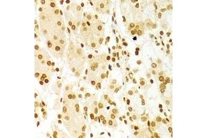 Immunohistochemistry of paraffin-embedded human stomach using DKC1 Antibody (ABIN5970956) at dilution of 1/100 (40x lens). (DKC1 抗体)