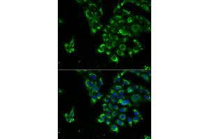 Immunofluorescence analysis of U2OS cells using TSHB antibody. (TSHB 抗体)