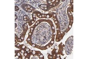 Immunohistochemical staining of human small intestine with ZNF780B polyclonal antibody  shows strong cytoplasmic and membranous positivity in glandular cells at 1:20-1:50 dilution. (ZNF780B 抗体)